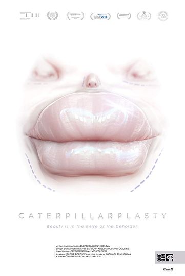 성형중독 Caterpillarplasty 사진