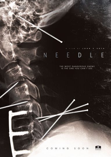 針 Needle Foto